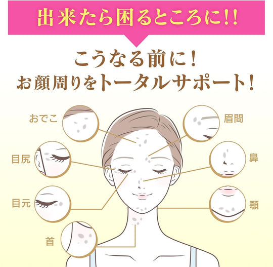 Keshimin Beauty Serum Prevents Spots and Freckles 30ml by Kobayashi Pharmaceutical - WAFUU JAPAN
