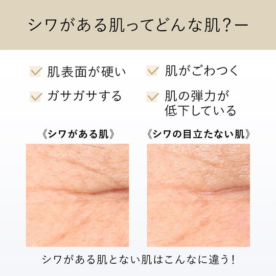 Shiseido ELIXIR Superieur Retino Power Wrinkle Cream Anti Aging Care 15g - WAFUU JAPAN