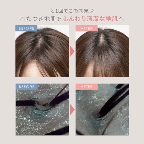 YA - MAN MIEZE Needle Head Spa Lift Active Electric Scalp Brush MS32G Black AC100~240V - WAFUU JAPAN